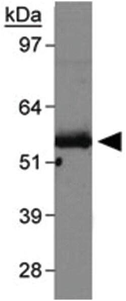 SLC2A9 Rabbit anti-Mouse, Polyclonal Antibody, Abnova 100&mu;L; Unlabeled:Antibodies,