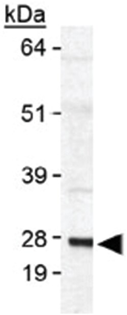 SAT1, Rabbit, Polyclonal Antibody, Abnova 100&mu;L; Unlabeled:Antibodies,
