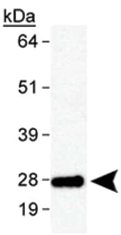 PTGDS Rabbit anti-Bovine, Cat, Horse, Human, Mouse, Pig, Primates, Rabbit, Rat, Polyclonal Antibody, Abnova 100 &mu;L | Buy Online | Abnova Corporation | Fisher Scientific