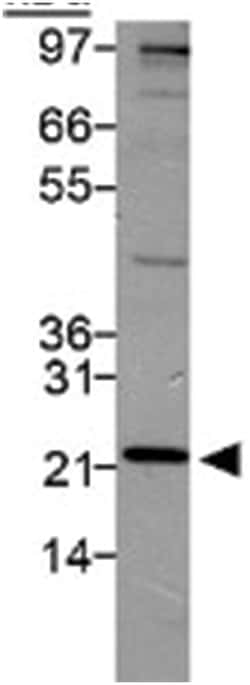 PSMD10 Rabbit anti-Bovine, Human, Mouse, Pig, Rat, Zebra fish, Polyclonal Antibody, Abnova 100 &mu;L | Buy Online | Abnova | Fisher Scientific