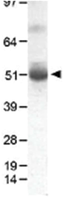 PDK1 Rabbit anti-Bovine, Chicken, Human, Mouse, Pig, Primates, Rat, Zebra