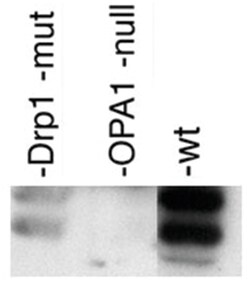 OPA1, Rabbit, Polyclonal Antibody, Abnova 100 &mu;L | Buy Online | Abnova Corporation | Fisher Scientific