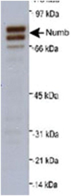 NUMB Rabbit anti-Chicken, Human, Mouse, Rat, Polyclonal Antibody, Abnova