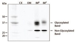 Aqp2 Rabbit anti-Bovine, Human, Mouse, Pig, Rat, Sheep, Polyclonal Antibody,