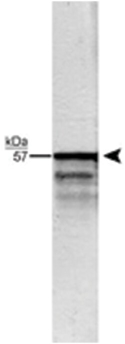 PRPH Rabbit anti-Human, Mammals, Polyclonal Antibody, Abnova 100&mu;L;