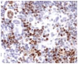 MKI67 Rabbit anti-Human, Mouse, Polyclonal Antibody, Abnova 100&mu;L; Unlabeled:Antibodies,