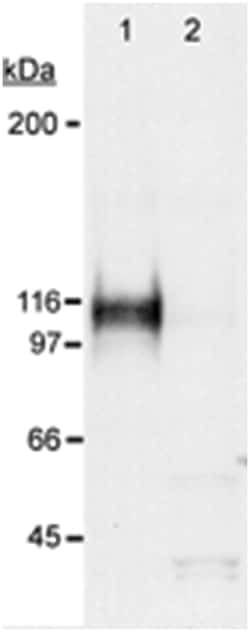 HIF1A Rabbit anti-Human, Mouse, Primates, Rat, Polyclonal Antibody, Abnova
