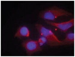 GRIN2B (phospho Y1474), Rabbit anti-Human, Mouse, Rat, Polyclonal Antibody,