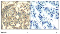 MET Rabbit anti-Human, Mouse, Rat, Polyclonal Antibody, Abnova 100&mu;g;