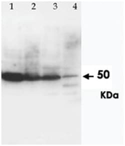 CCR6 Rabbit anti-Human, Mouse, Rat, Polyclonal Antibody, Abnova 100&mu;g;