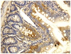 CCR6 Rabbit anti-Human, Mouse, Rat, Polyclonal Antibody, Abnova 100&mu;g;