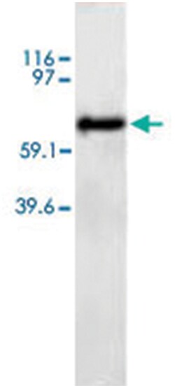 ANGPT2 Rabbit anti-Human, Rat, Polyclonal Antibody, Abnova 100&mu;g; Unlabeled:Antibodies,