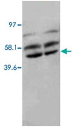 PPP2CA Rabbit anti-Human, Mouse, Rat, Polyclonal Antibody, Abnova 100&mu;g;