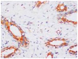 PPP2CA Rabbit anti-Human, Mouse, Rat, Polyclonal Antibody, Abnova 100&mu;g;