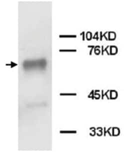 PTPN11 Rabbit anti-Human, Mouse, Rat, Polyclonal Antibody, Abnova 100&mu;g;