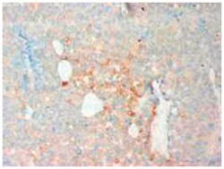 ITGB2 Rabbit anti-Human, Polyclonal Antibody, Abnova 100&mu;g; Unlabeled:Antibodies,