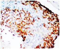 PTGS2 Rabbit anti-Human, Mouse, Rat, Polyclonal Antibody, Abnova 100&mu;g;