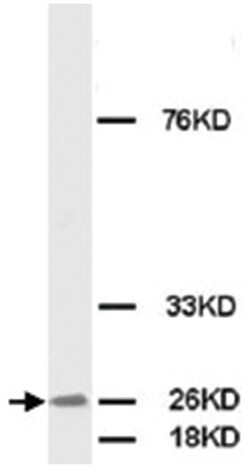 FGF8, Rabbit, Polyclonal Antibody, Abnova 100&mu;g; Unlabeled:Antibodies,