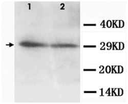 AQP5 Rabbit anti-Human, Mouse, Rat, Polyclonal Antibody, Abnova 100&mu;g;