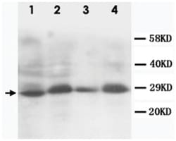SSX2, Rabbit, Polyclonal Antibody, Abnova 100&mu;g; Unlabeled:Antibodies,