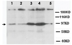 CXCR4 Rabbit anti-Human, Mouse, Rat, Polyclonal Antibody, Abnova 100&mu;g;