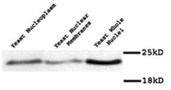 MAD2, Rabbit, Polyclonal Antibody, Abnova 100&mu;L; Unlabeled:Antibodies,