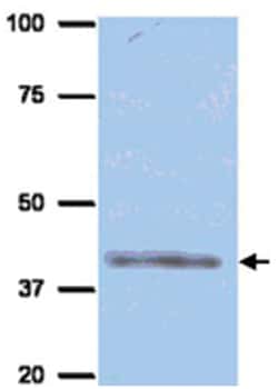 AURKB, Sheep, Polyclonal Antibody, Abnova 200&mu;L; Unlabeled:Antibodies,