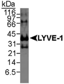 LYVE1 Rabbit anti-Human, Mouse, Polyclonal Antibody, Abnova 100&mu;L; Unlabeled:Antibodies,