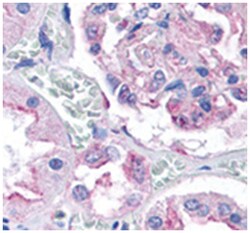 DNM1L Rabbit anti-Bovine, Human, Mouse, Primates, Rat, Polyclonal Antibody,