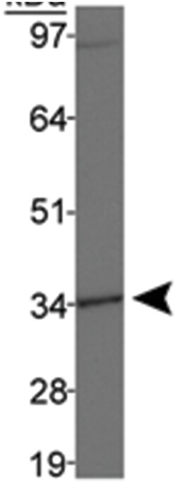 DLX4 Rabbit anti-Human, Polyclonal Antibody, Abnova 100 &mu;L | Buy Online | Abnova | Fisher Scientific