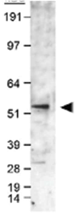 CYP19A1 Rabbit anti-Bovine, Horse, Human, Primates, Rabbit, Polyclonal Antibody, Abnova 100 &mu;L | Buy Online | Abnova Corporation | Fisher Scientific