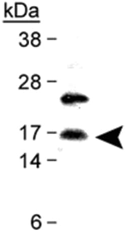 CDKN2A Rabbit anti-Human, Polyclonal Antibody, Abnova 100&mu;L; Unlabeled:Antibodies,