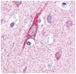 ATP13A2 Rabbit anti-Human, Mouse, Polyclonal Antibody, Abnova 100&mu;L;