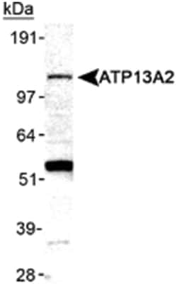 ATP13A2 Rabbit anti-Human, Mouse, Polyclonal Antibody, Abnova 100&mu;L;