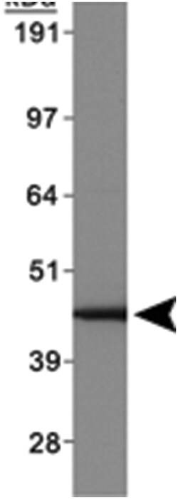 ABHD5 Rabbit anti-Human, Polyclonal Antibody, Abnova 100&mu;L; Unlabeled:Antibodies,