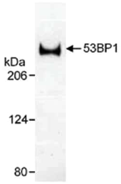 TP53BP1 Rabbit anti-Human, Mouse, Polyclonal Antibody, Abnova 100&mu;L;