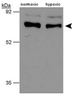 P4HTM, Rabbit, Polyclonal Antibody, Abnova 100 &mu;L | Buy Online | Abnova Corporation | Fisher Scientific