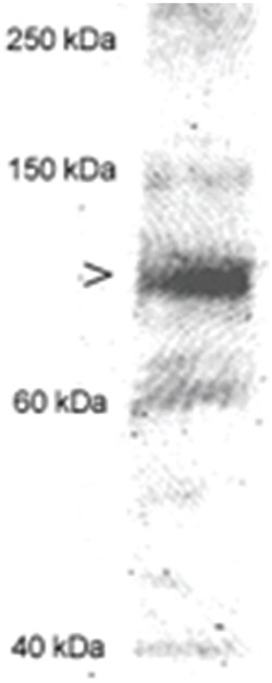 MLXIPL Rabbit anti-Human, Mouse, Rat, Polyclonal Antibody, Abnova 100 &mu;L | Buy Online | Abnova Corporation | Fisher Scientific