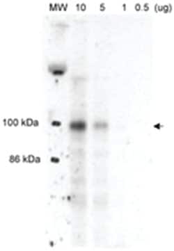 MLXIPL Rabbit anti-Human, Mouse, Rat, Polyclonal Antibody, Abnova 100 &mu;L | Buy Online | Abnova Corporation | Fisher Scientific