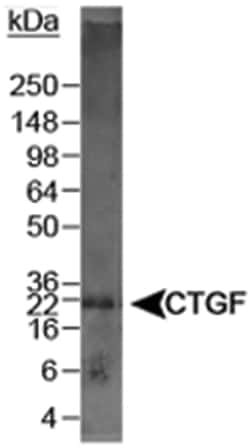 CTGF, Rabbit, Polyclonal Antibody, Abnova 100&mu;L; Unlabeled:Antikörper
