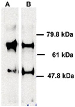 ABCE1 Rabbit anti-Human, Polyclonal Antibody, Abnova 100 &mu;L | Buy Online | Abnova Corporation | Fisher Scientific