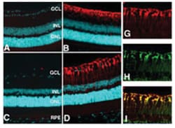 GLUL Rabbit anti-Bovine, Human, Mouse, Rat, Polyclonal Antibody, Abnova