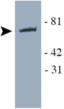 YAP1 Rabbit anti-Human, Polyclonal Antibody, Abnova 100&mu;L; Unlabeled:Antibodies,