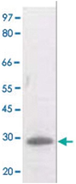 BCL2 (phospho T129), Rabbit anti-Human, Mouse, Rat, Polyclonal Antibody, Abnova 100 &mu;g | Buy Online | Abnova | Fisher Scientific