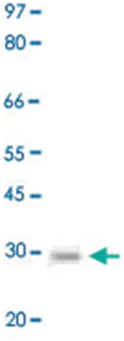 BCL2 (phospho S70), Rabbit anti-Human, Polyclonal Antibody, Abnova 100 &mu;g | Buy Online | Abnova Corporation | Fisher Scientific