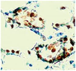 ESR1 (phospho S167), Rabbit anti-Human, Polyclonal Antibody, Abnova 100&mu;g;