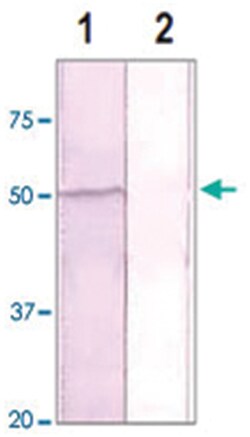 GSK3A (phospho S21), Rabbit anti-Human, Mouse, Rat, Polyclonal Antibody,