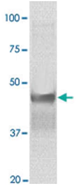 GSK3B (phospho S9), Rabbit anti-Human, Mouse, Rat, Polyclonal Antibody,