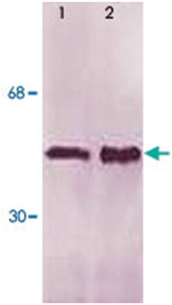 LSP1 (phospho S252), Rabbit anti-Human, Mouse, Polyclonal Antibody, Abnova 100 &mu;g | Buy Online | Abnova Corporation | Fisher Scientific