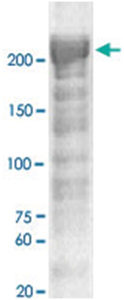 NF1 Rabbit anti-Bovine, Dog, Human, Mouse, Rat, Polyclonal Antibody, Abnova 100 &mu;g | Buy Online | Abnova Corporation | Fisher Scientific